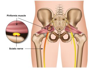 piriformis syndrome cycling athletes