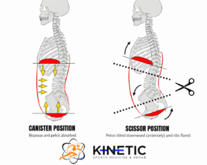 intra-abdominal pressure lower back pain